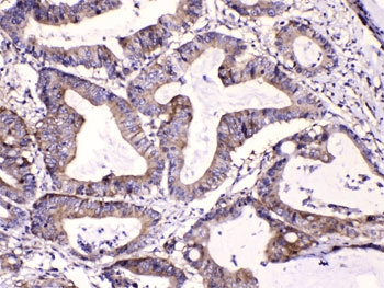 CAST / Calpastatin Antibody