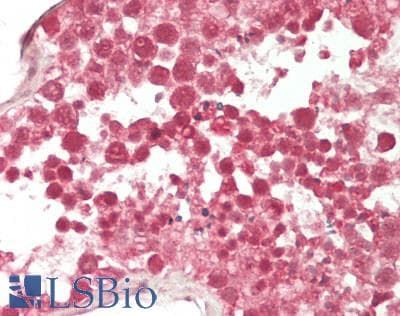 IHC-plus™ Polyclonal Rabbit anti-Human KLHL28 / BTBD5 Antibody (IHC, WB)