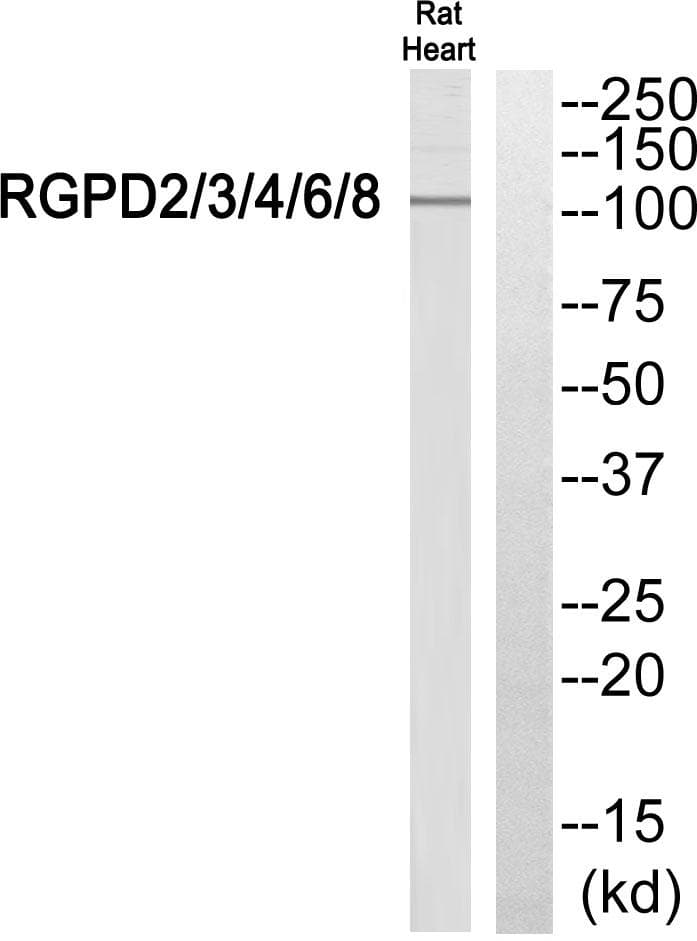 Polyclonal Rabbit anti-Human RGPD2+3+4+6+8 Antibody (WB)