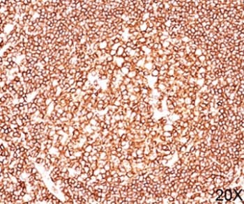 CD45 / LCA Antibody (clone 2B11 + PD7/26, Ready-to-Use)