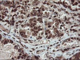 UBE2E3 Antibody (clone OTI7E8)