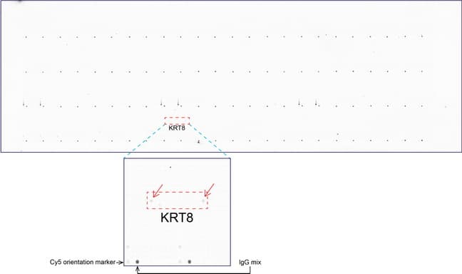 KRT8 / CK8 / Cytokeratin 8 Antibody (aa91-381, clone UMAB1)