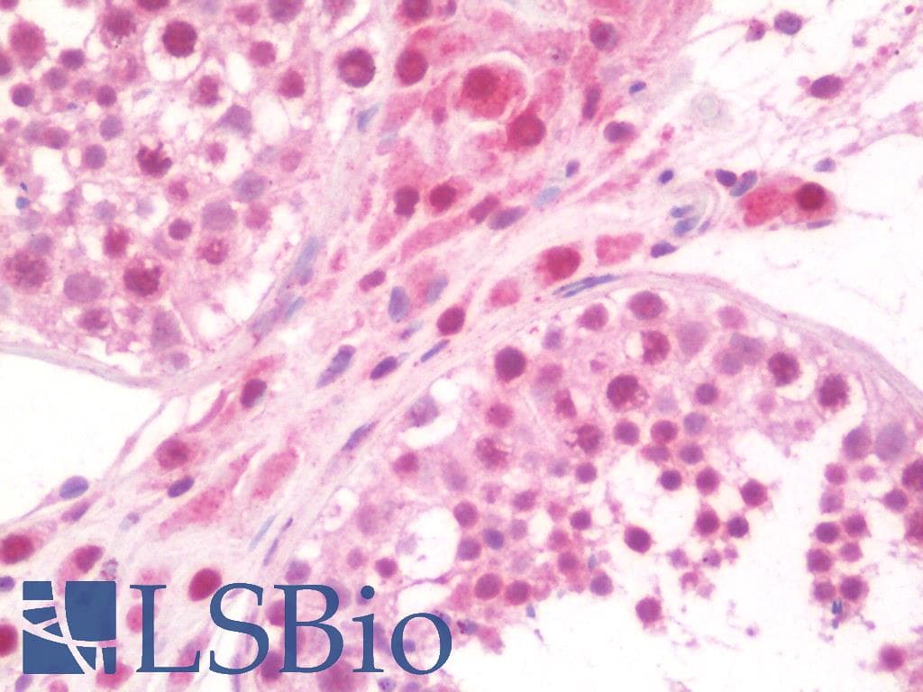 IHC-plus™ C/EBP Delta / CEBPD Antibody