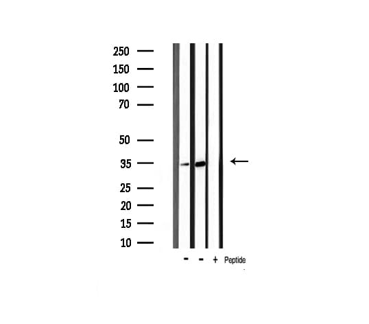 CDK5 Antibody (phospho-Tyr15)