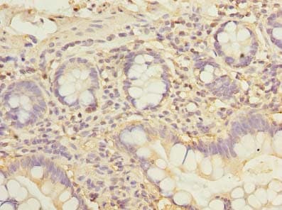 IHC-plus™ Polyclonal Rabbit anti-Human ZDHHC2 Antibody (IHC, IF)