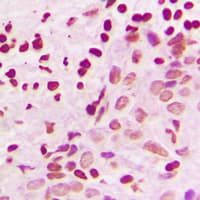 Polyclonal Rabbit anti-Human MEK3/6 Antibody (Internal, IHC, IF, WB)