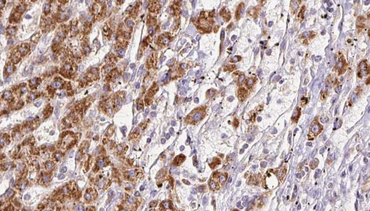 SEMA4D / Semaphorin 4D / CD100 Antibody