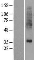 PTDSS1 Protein (Over-Expression Lysate Myc-DDK (Flag))
