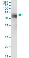 Monoclonal Mouse anti-Human PDPK1 / PDK1 Antibody (clone 2E2, WB)