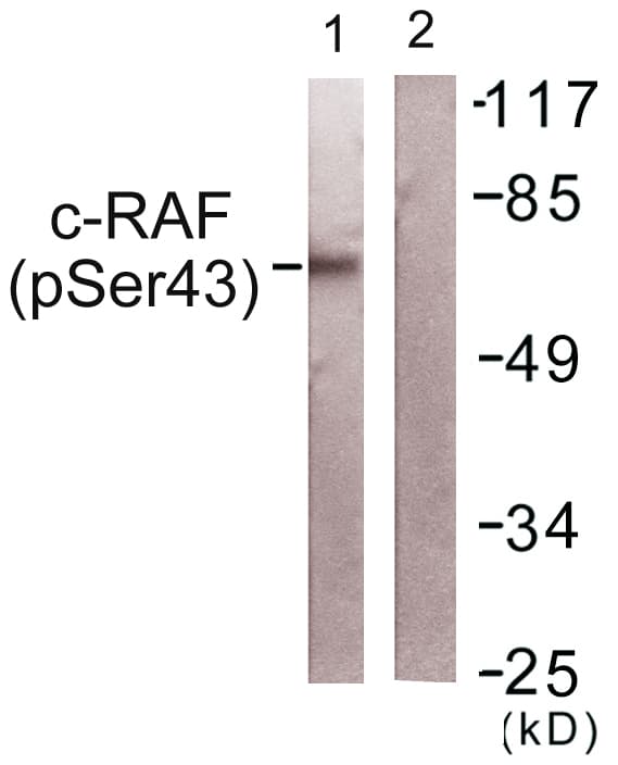 RAF1 / RAF Antibody (phospho-Ser43)