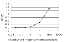 GRM2 / MGLUR2 Antibody (clone 3H7)