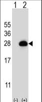 Polyclonal Rabbit anti-Human RAB3B Antibody (aa170-196, WB)