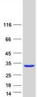 Human PSPH Protein (Recombinant Myc-DDK (Flag))