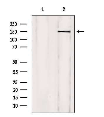 Treacle / TCOF1 Antibody