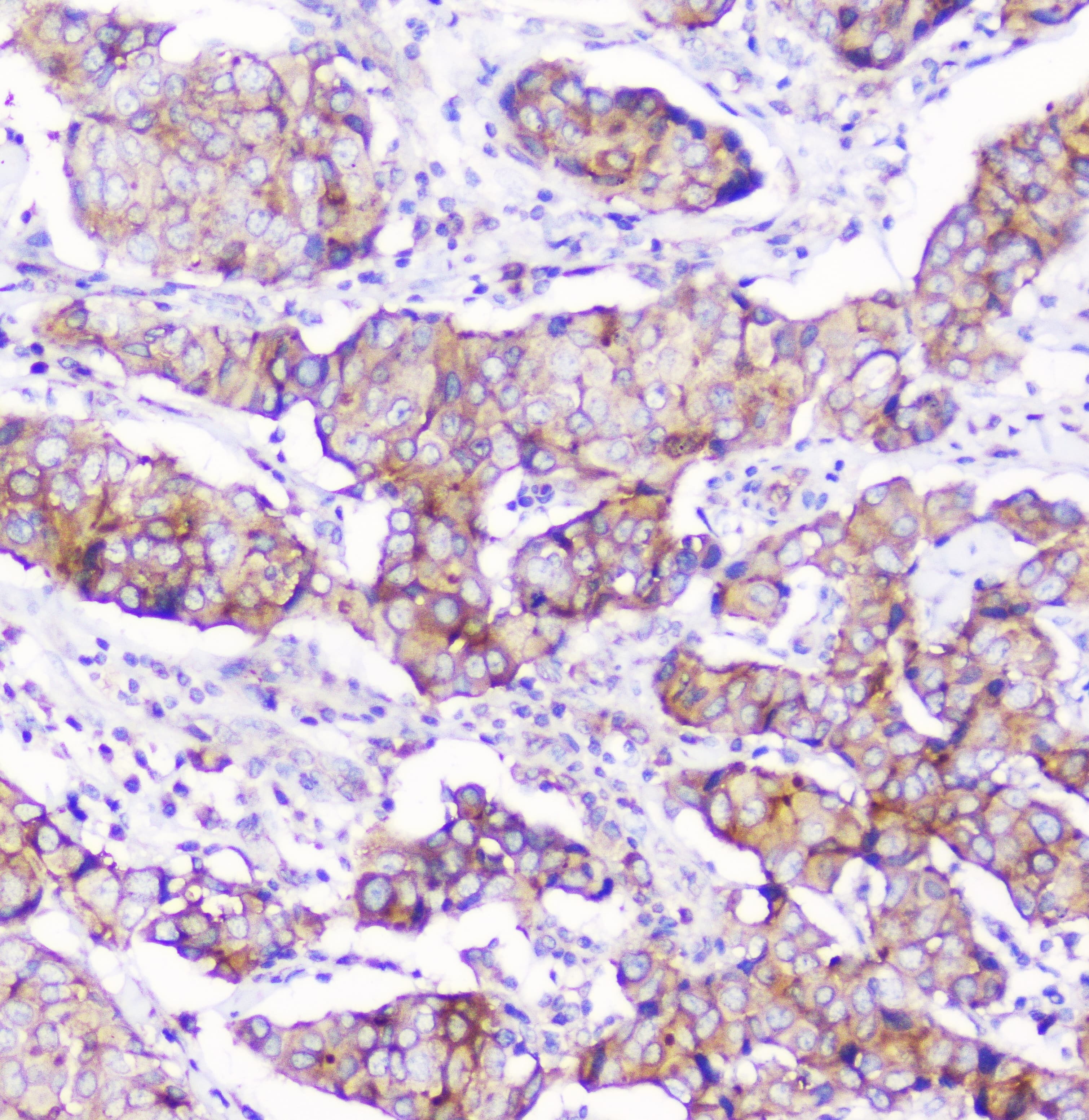 CD2AP Antibody