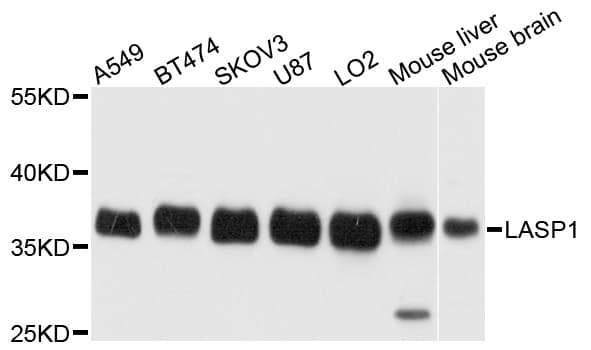 LASP1 Antibody