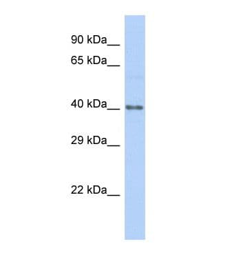 HKR1 Antibody (C-Terminus)