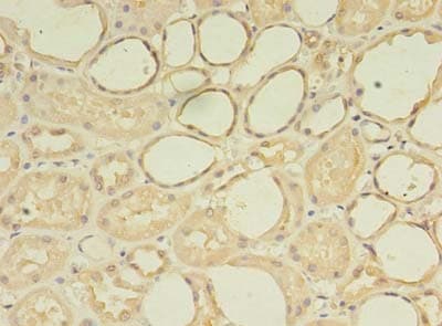 ZNF133 Antibody