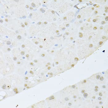 Polyclonal Rabbit anti-Human AKT1 Antibody (IHC, IF, WB)