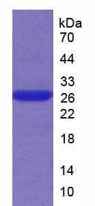 Human CMA1 / Mast Cell Chymase Protein (Recombinant His, N-Terminal)
