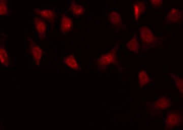 Polyclonal Rabbit anti-Human BSAC / MKL1 Antibody (IF, WB)