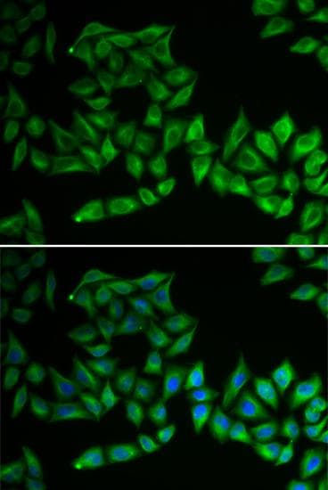TPMT Antibody