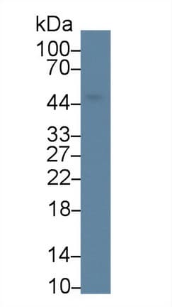 AGK Antibody (aa15-300, PE)