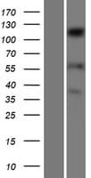 SENP6 Protein (Over-Expression Lysate Myc-DDK (Flag))