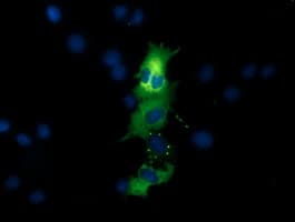 Monoclonal Mouse anti-Human QPRT Antibody (clone OTI3B3, IF, WB)