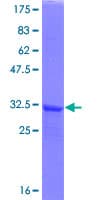 Human SEPHS2 Protein (Recombinant GST)
