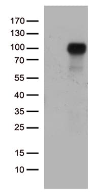 EPHA1 / EPH Receptor A1 Antibody (aa24-327, clone OTI2D6)