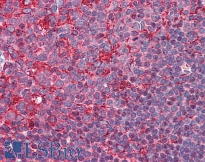 IHC-plus™ PDI / P4HB Antibody