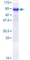 Human KPNA6 Protein (Recombinant GST)