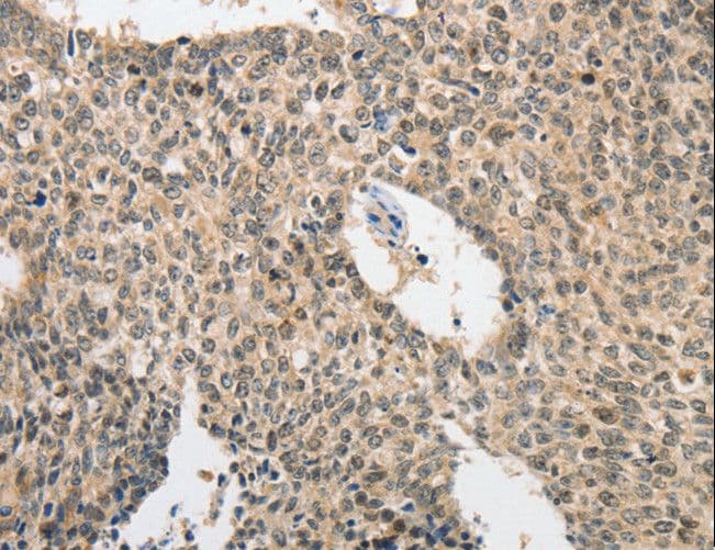 Polyclonal Rabbit anti-Human APG5 / ATG5 Antibody (IHC)