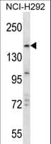 TRIM33 / TIF1-Gamma Antibody (aa820-849)