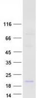 Human DEFB118 Protein (Recombinant Myc-DDK (Flag))