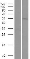 TMEM161A Protein (Over-Expression Lysate Myc-DDK (Flag))