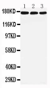 Polyclonal Rabbit anti-Human LRP5 Antibody (aa1201-1215, WB)