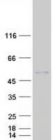 Human AMBP Protein (Recombinant Myc-DDK (Flag))