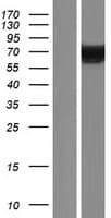 Human KIAA0828 / AHCYL2 Protein (Over-Expression Lysate Myc-DDK (Flag))