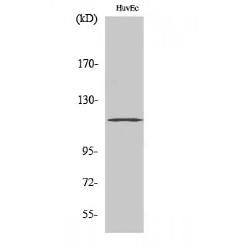 Polyclonal Rabbit anti-Human ST18 Antibody (10-90 aa, N-terminal, IHC, IF, WB)