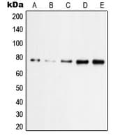PRKCZ / PKC-Zeta Antibody (phospho-Thr560)