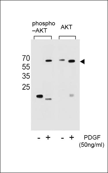AKT1 Antibody (phospho-Ser473)