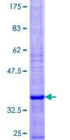 Human SEC61B Protein (Recombinant GST)
