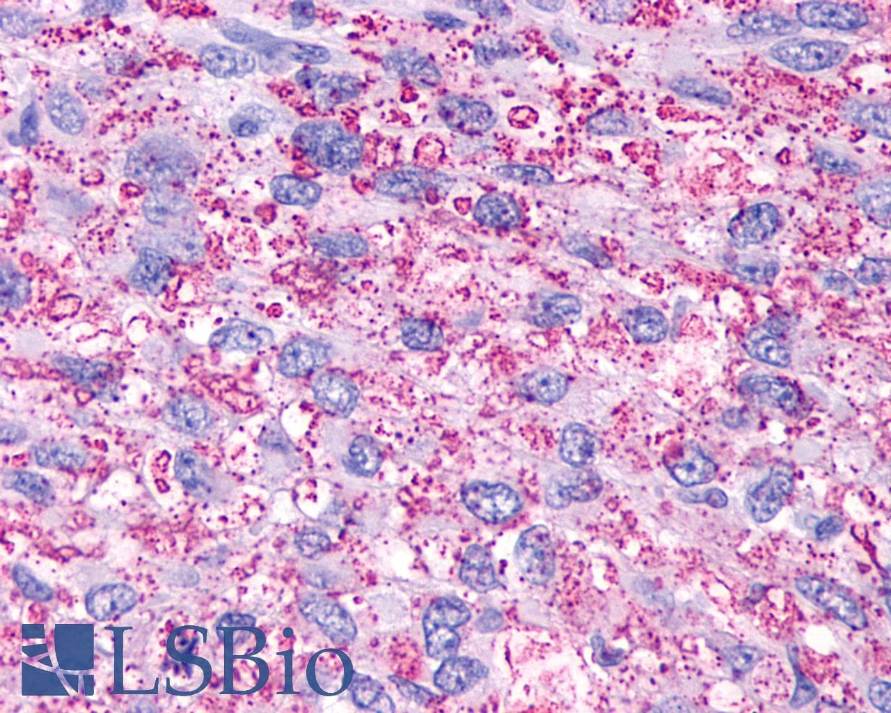 IHC-plus™ P2Y13 / P2RY13 Antibody (Extracellular Domain)
