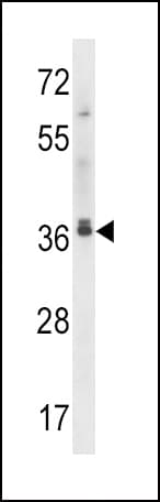 Polyclonal Rabbit anti-Human MAPRE2 / EB2 Antibody (aa12-40, WB)