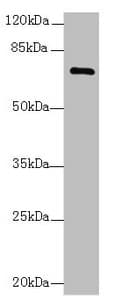 Polyclonal Rabbit anti-Human COLGALT2 / GLT25D2 Antibody (IHC, WB)