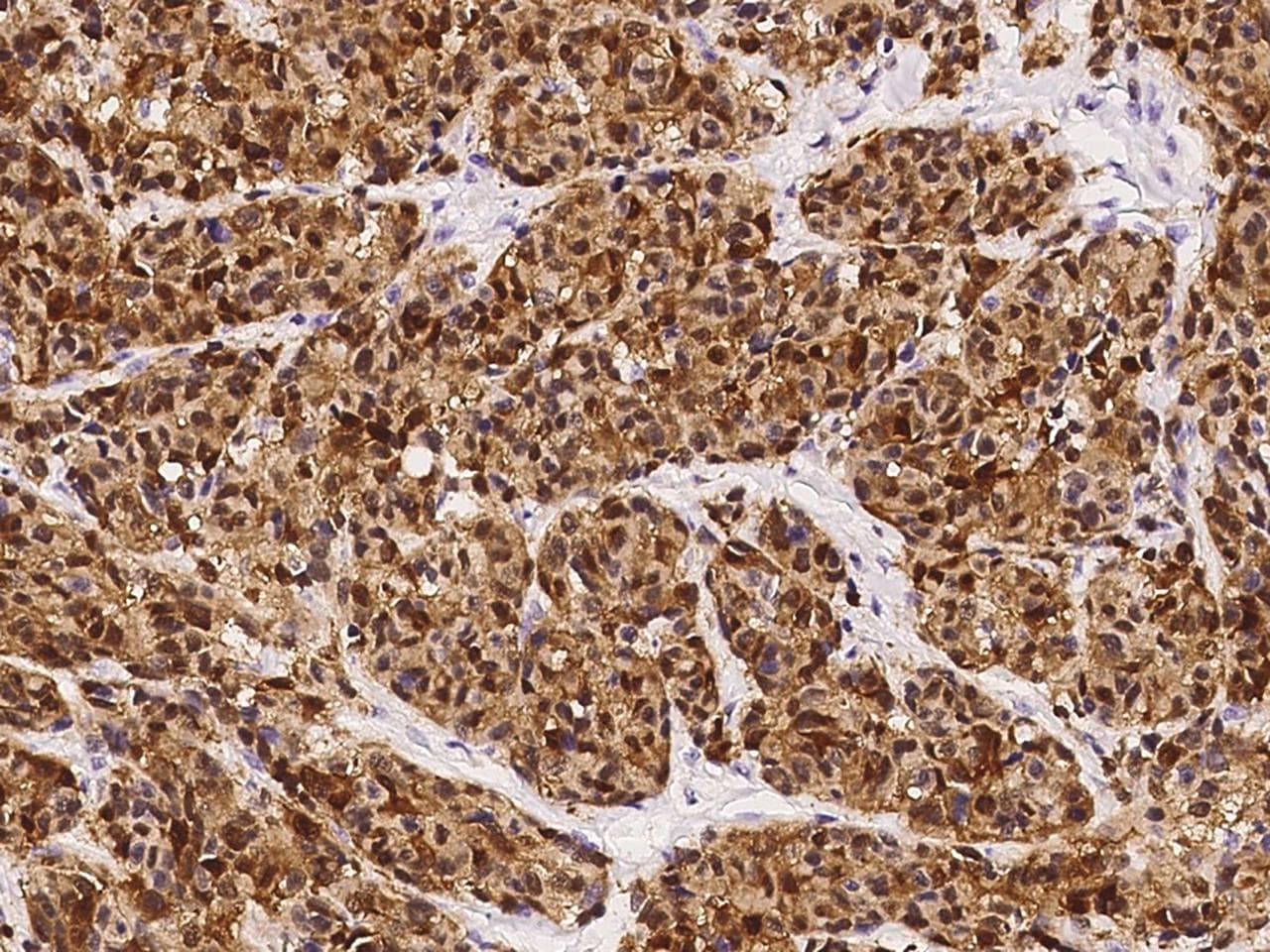 S100B / S100 Beta Antibody (clone 60, Preservative Free)