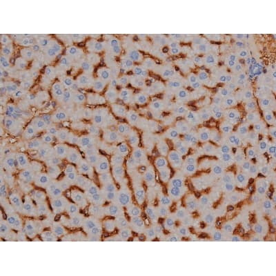 MAPT / Tau Antibody (phospho-Ser356)