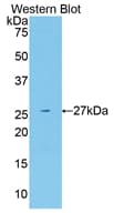 NRG1 / Heregulin / Neuregulin Antibody (aa20-242)